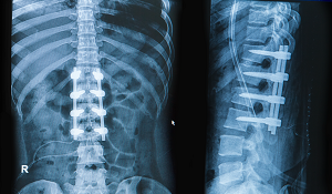 Medical Device ERP Software: Choosing The Right ERP For Medical Device Manufacturers