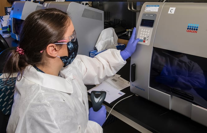 Why Are ERP Systems for Contract Development?